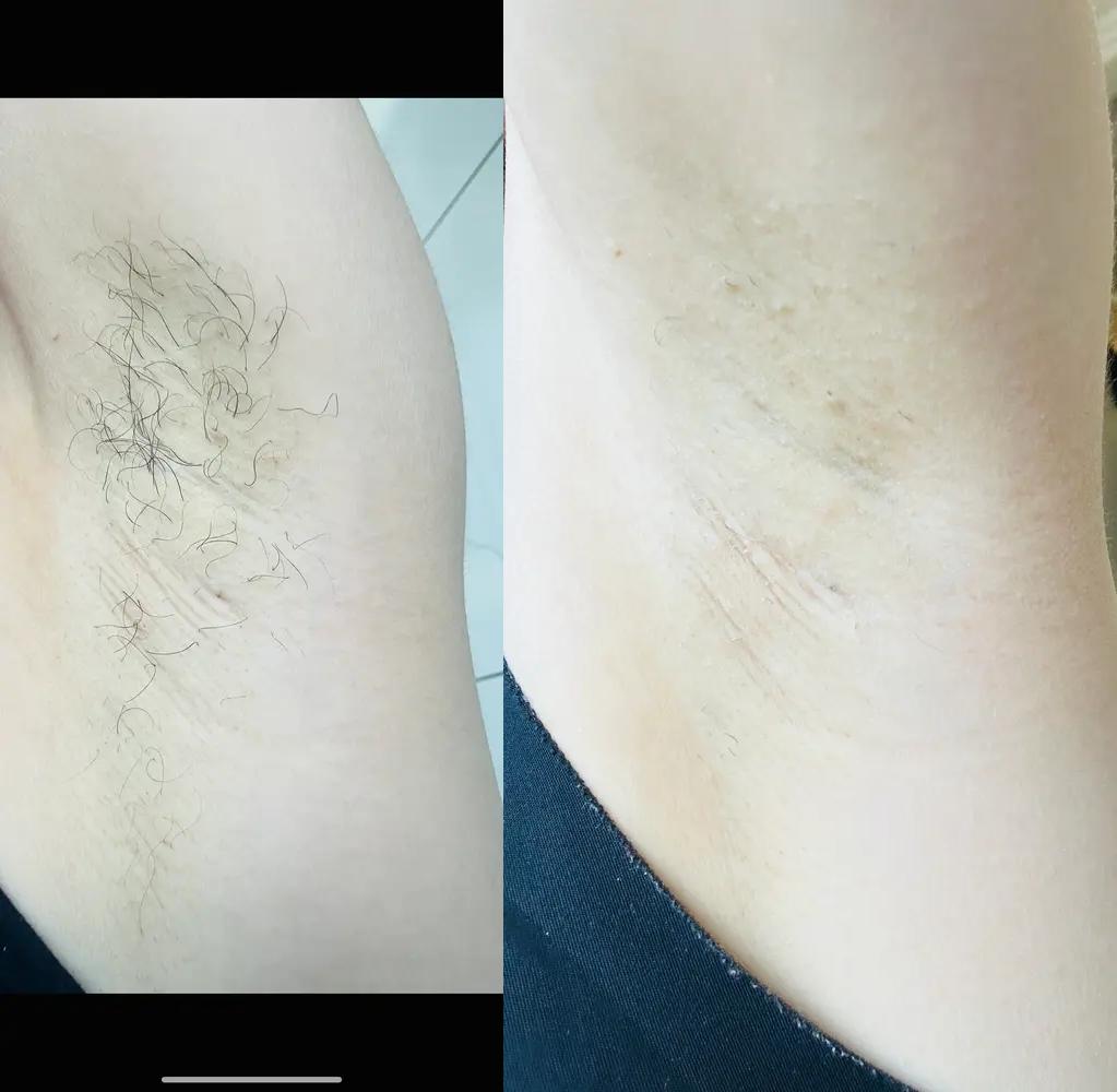 before-after-biovive_3693582a-7d1d-46c2-a434-8da5261b88d8.jpg
