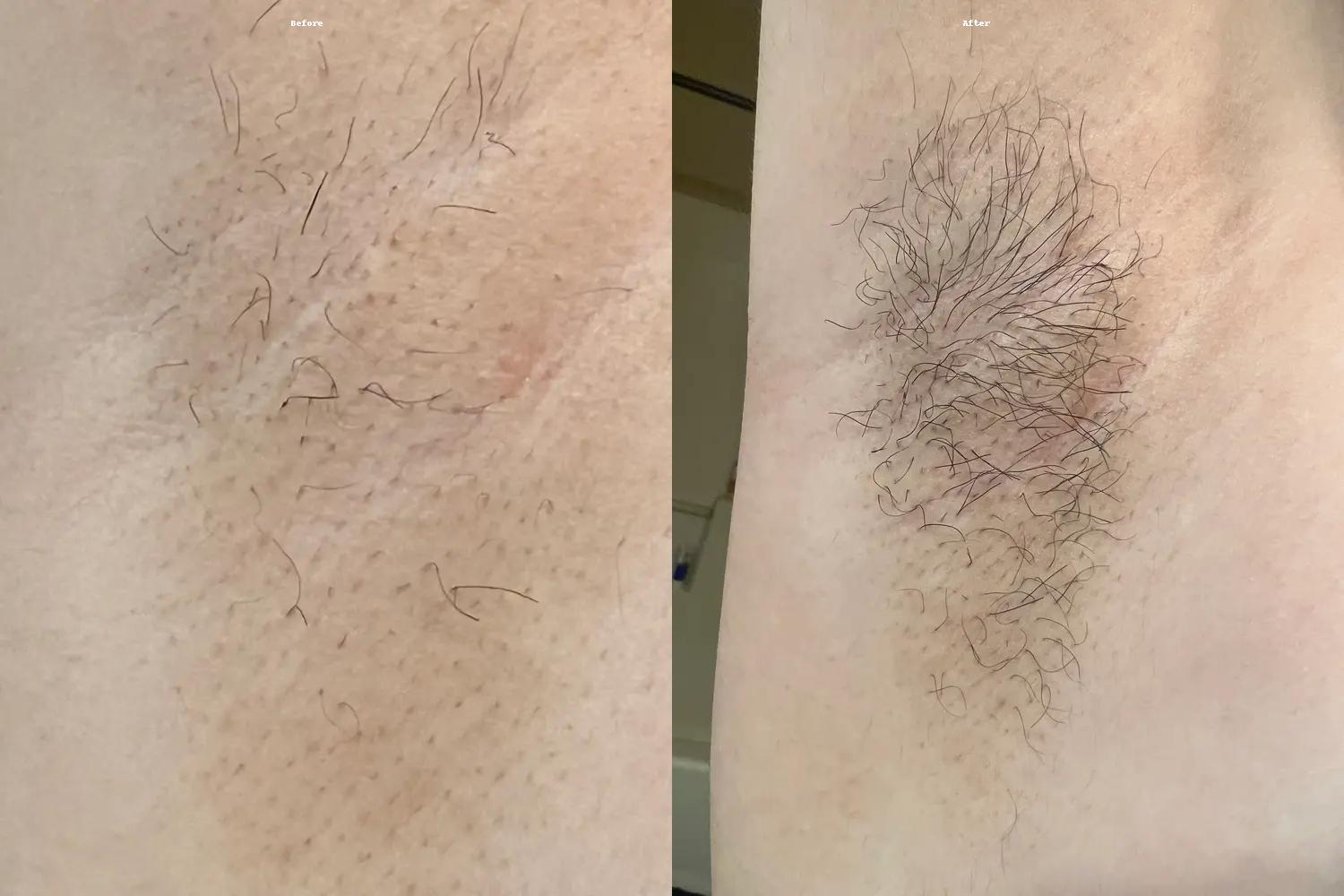 before_after_result_4.jpg