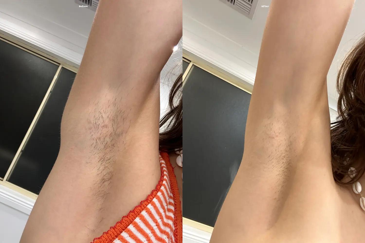before_after_result_5.jpg